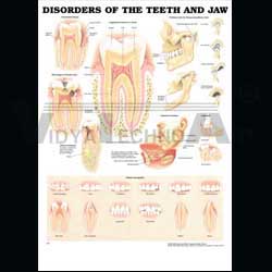 MEDICAL CHART DISCO TEETH & JAW